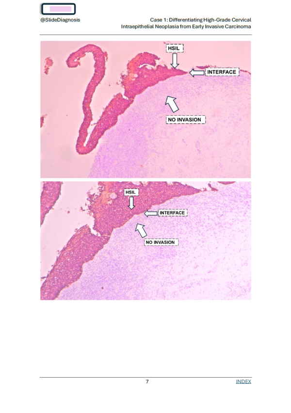 IHC Cases