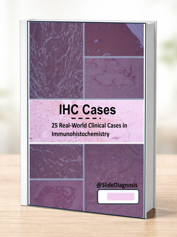 IHC cases